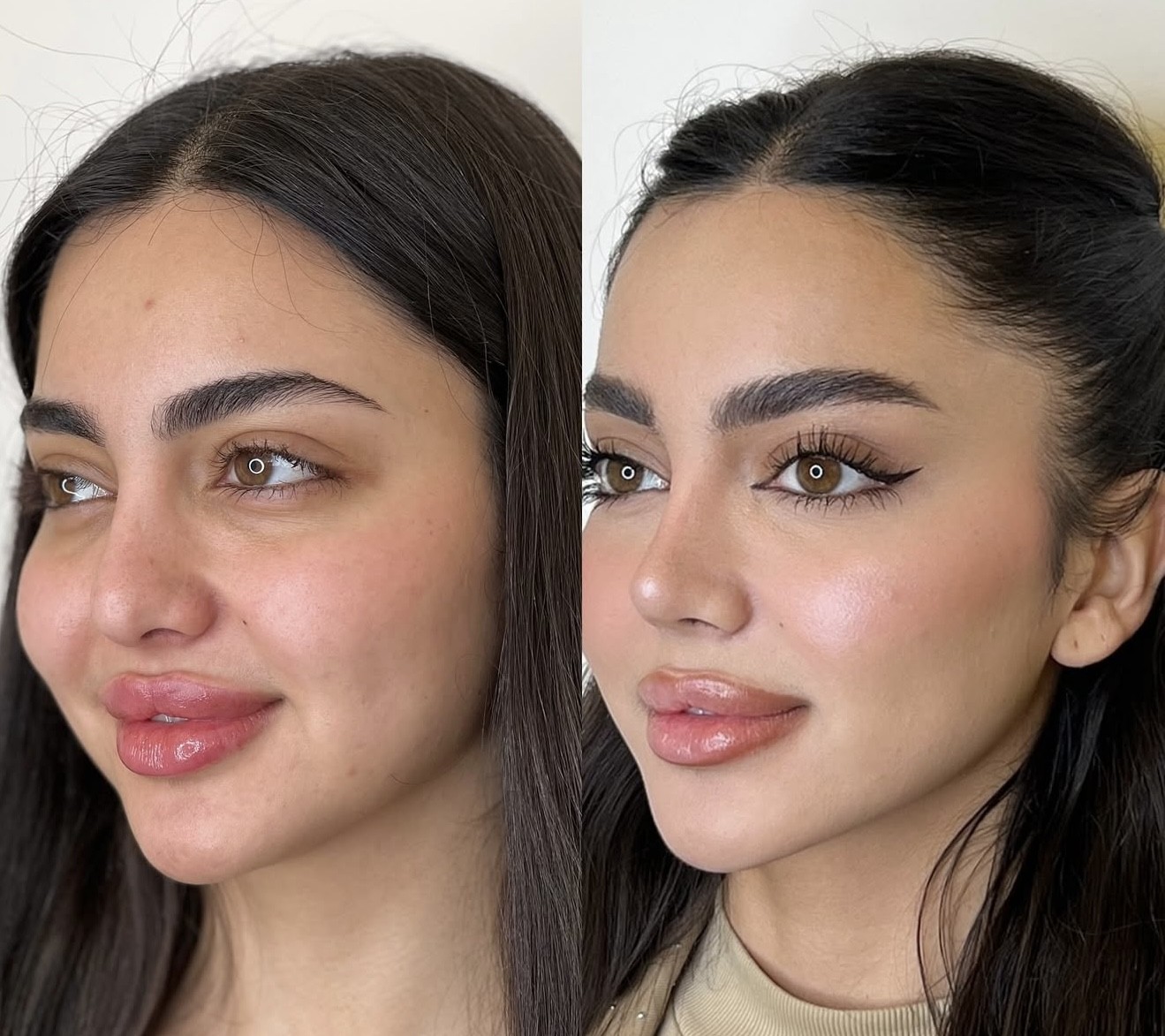 Facial Treatment 5