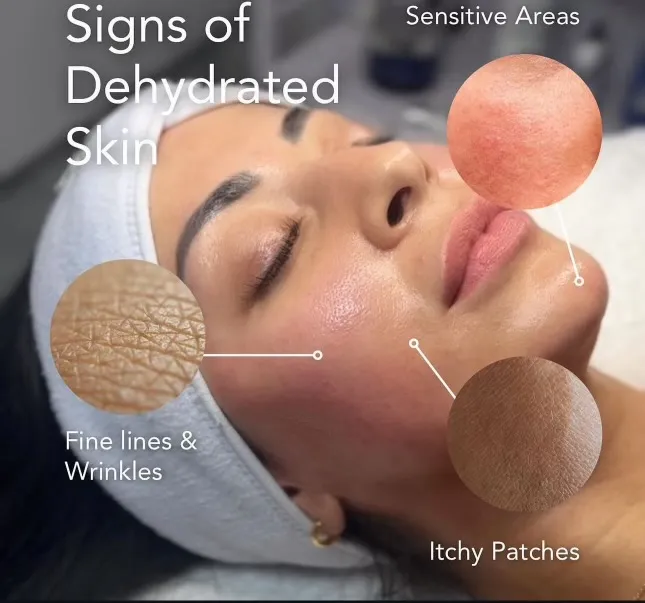Facial Treatment 1