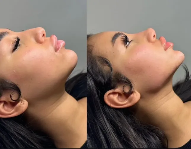 Customized Facial Treatment at Amoras Med Spa