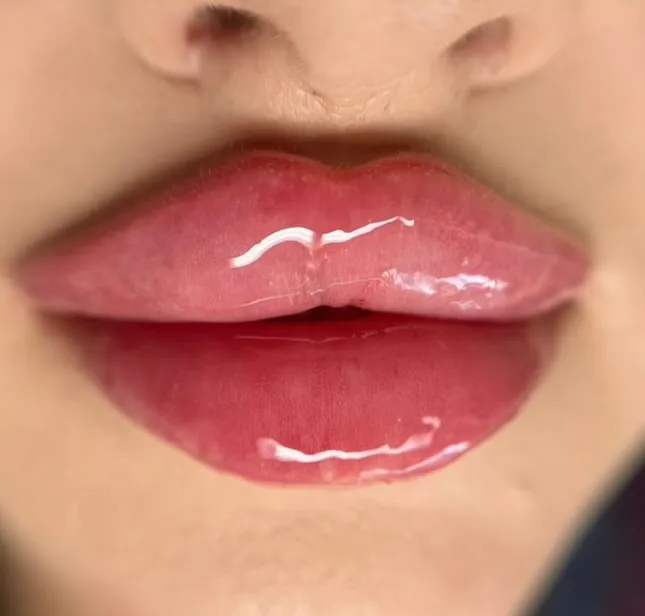 Lip Enhancement Results